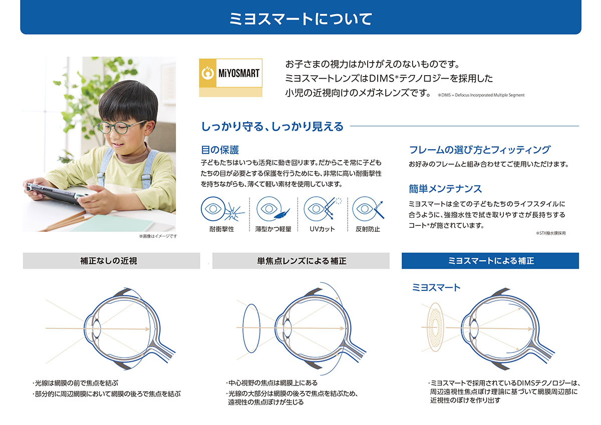 ミヨスマート（MiYOSMART）近視抑制メガネレンズ