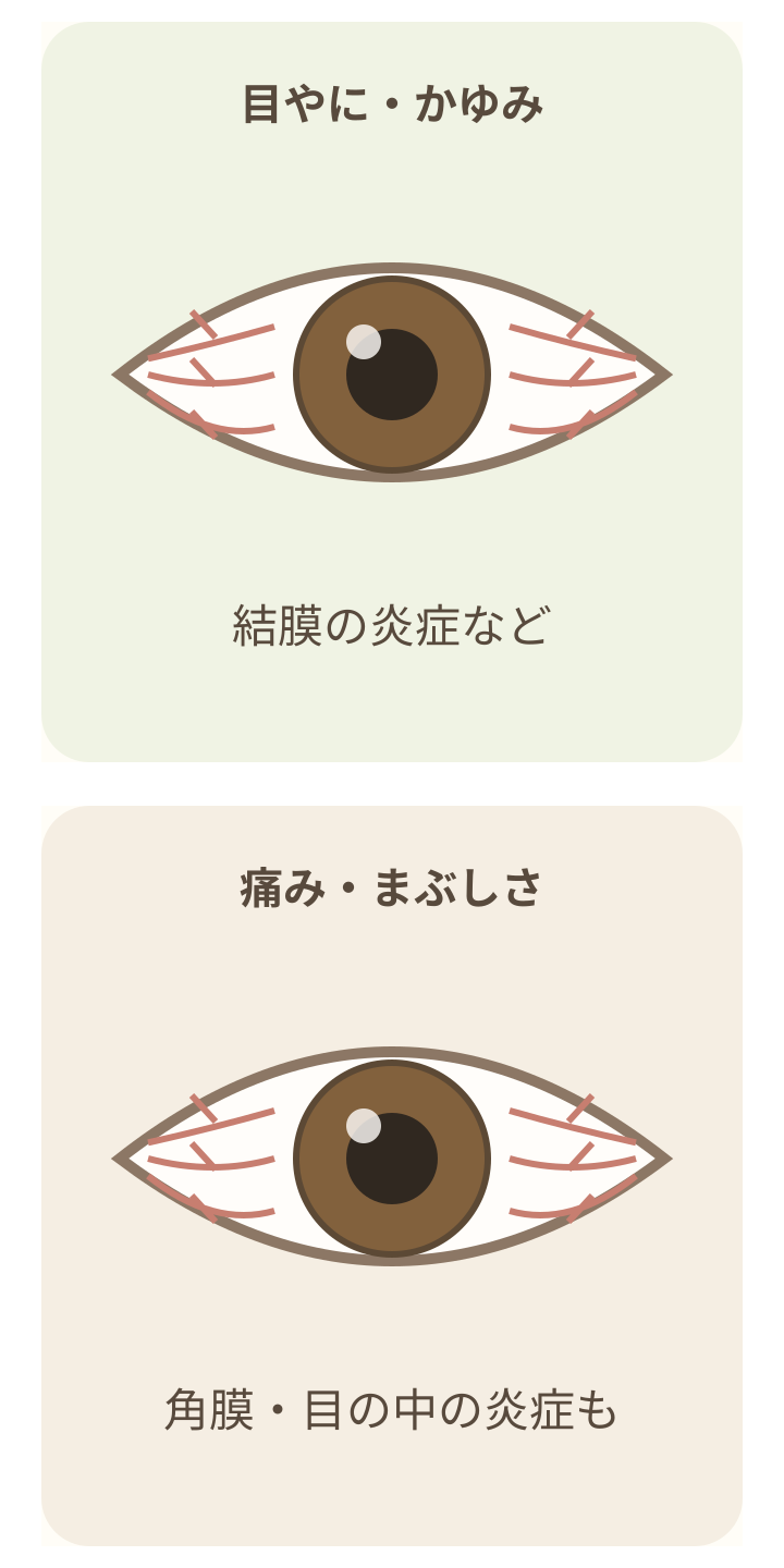 茶色い虹彩の目で、充血が似ていても伴う症状が異なることを示す模式図。