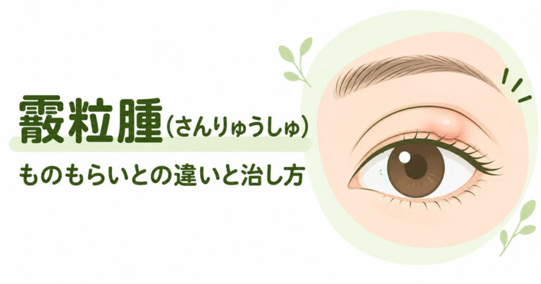 霰粒腫とは？治し方・自然に治る？ものもらいとの違い