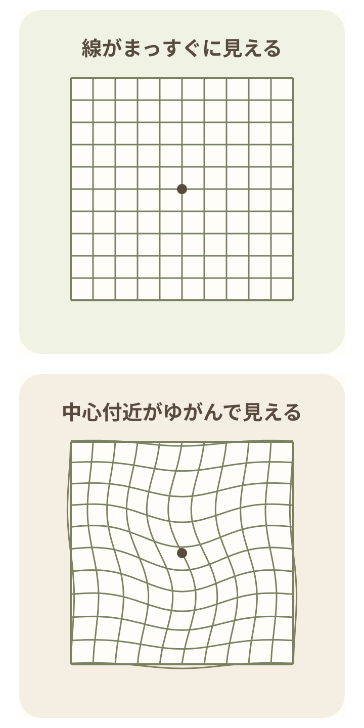 直線の格子と、中心付近の線が波打つ格子を比較した模式図。