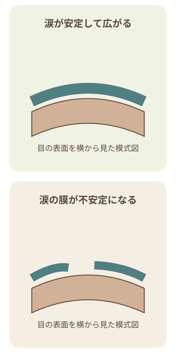 目の表面を覆う連続した涙の膜と、不安定になった涙の膜を比較する模式図。