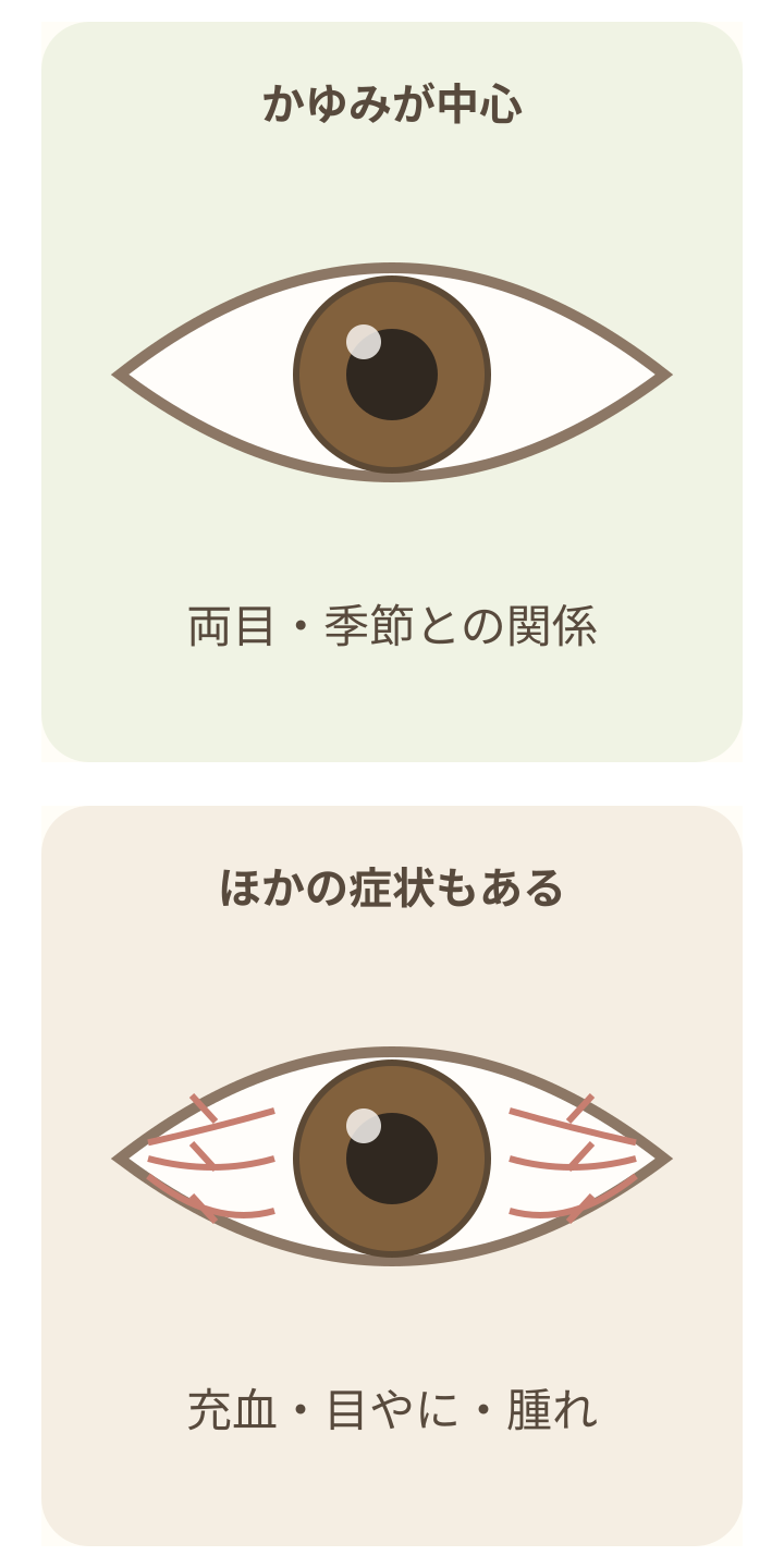 茶色い虹彩と白目の模式図。かゆみが中心の状態と、充血を伴う状態を比較。