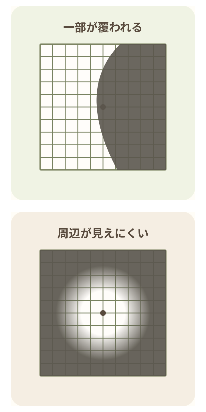 格子の一部分が覆われた見え方と、周辺が見えにくい状態を比較した模式図。
